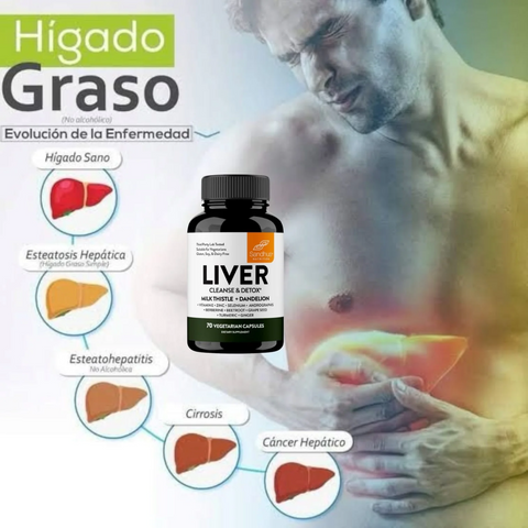 Image of LIVER™ - Desintoxica tu higado graso 💚