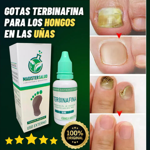 Image of GOTAS PARA LOS HONGOS EN LAS UÑAS