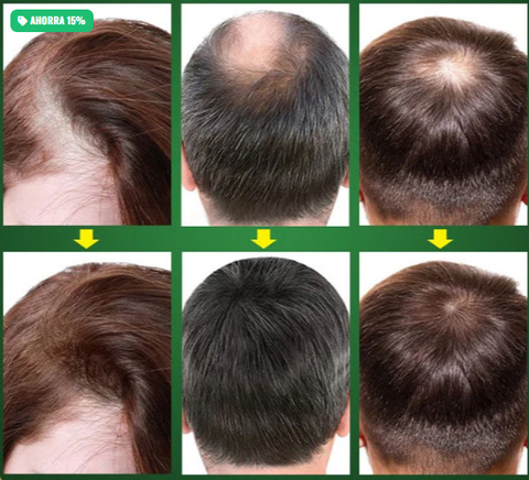 Image of Liquid Crece Cabello para Hombre y Mujer