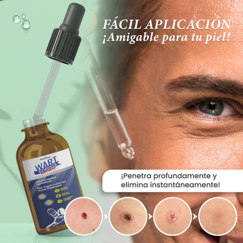 Image of Wart Remover - Removedor de Lunares y Verrugas