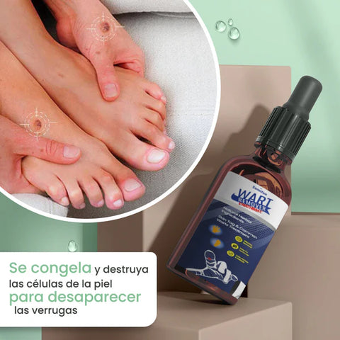 Image of Wart Remover - Removedor de Lunares y Verrugas