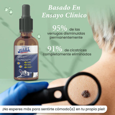 Image of Wart Remover - Removedor de Lunares y Verrugas