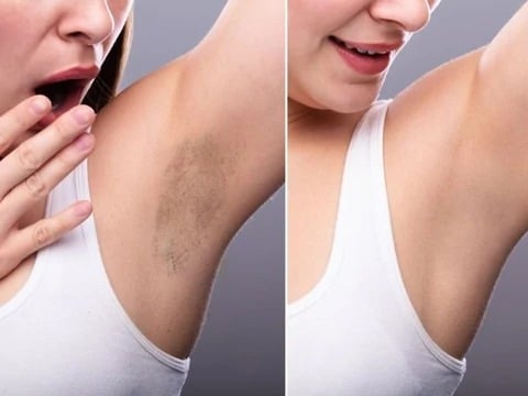 Image of La Mejor Crema Blanqueadora