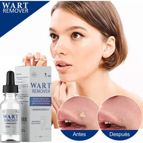 Image of WART REMOVER - REMOVEDOR DE VERRUGA